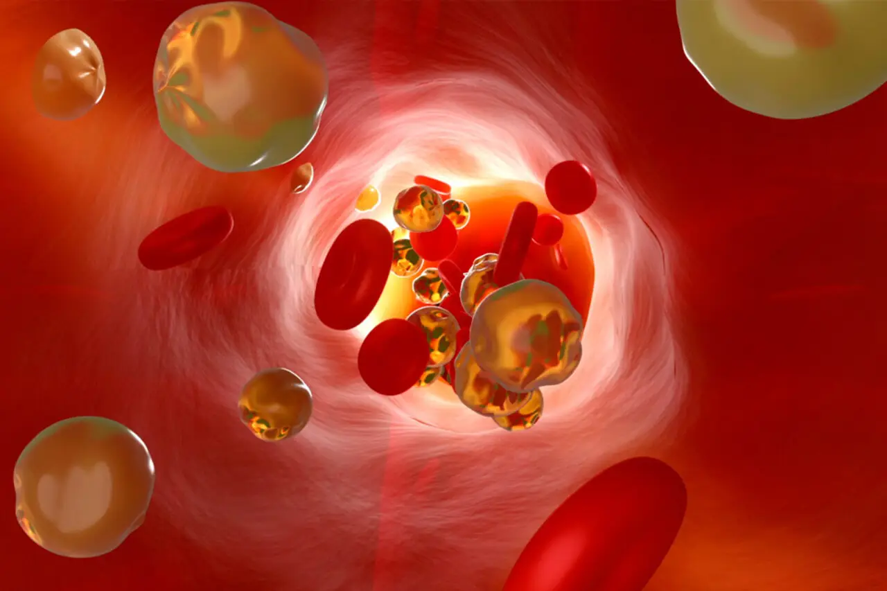 Leucemia: ecco cosa sapere su questa malattia del sangue