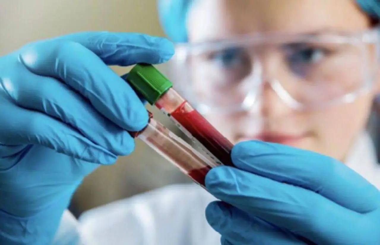 L’esame del sangue che potrebbe salvarti la vita: ecco cosa rivela davvero sul tuo metabolismo