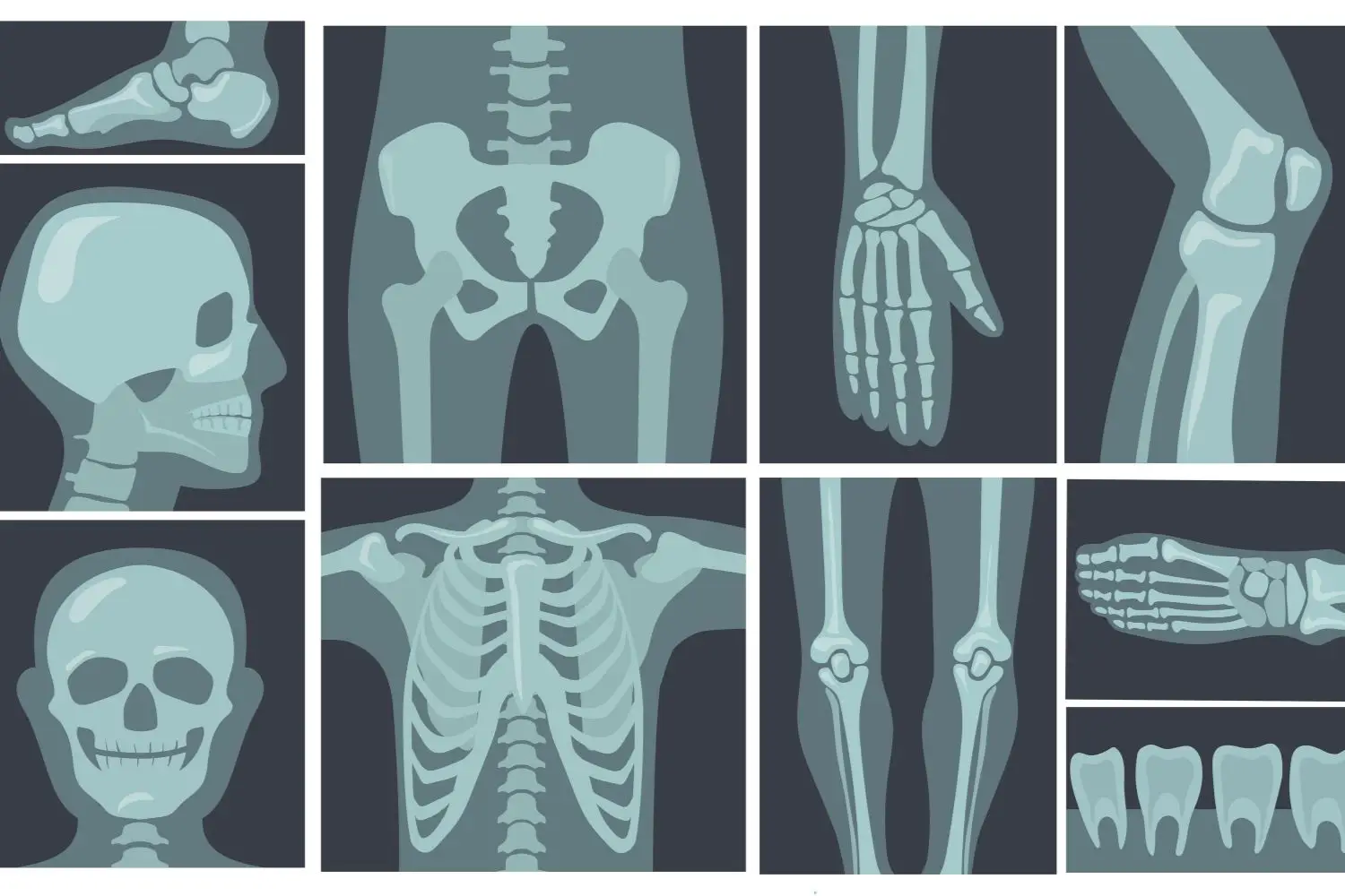 Ti fanno male tutte le ossa del corpo? Ecco le cause più comuni e quando preoccuparsi